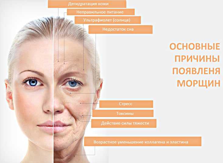 Как выровнять цвет лица - эффективные способы выравнивания тона кожи
