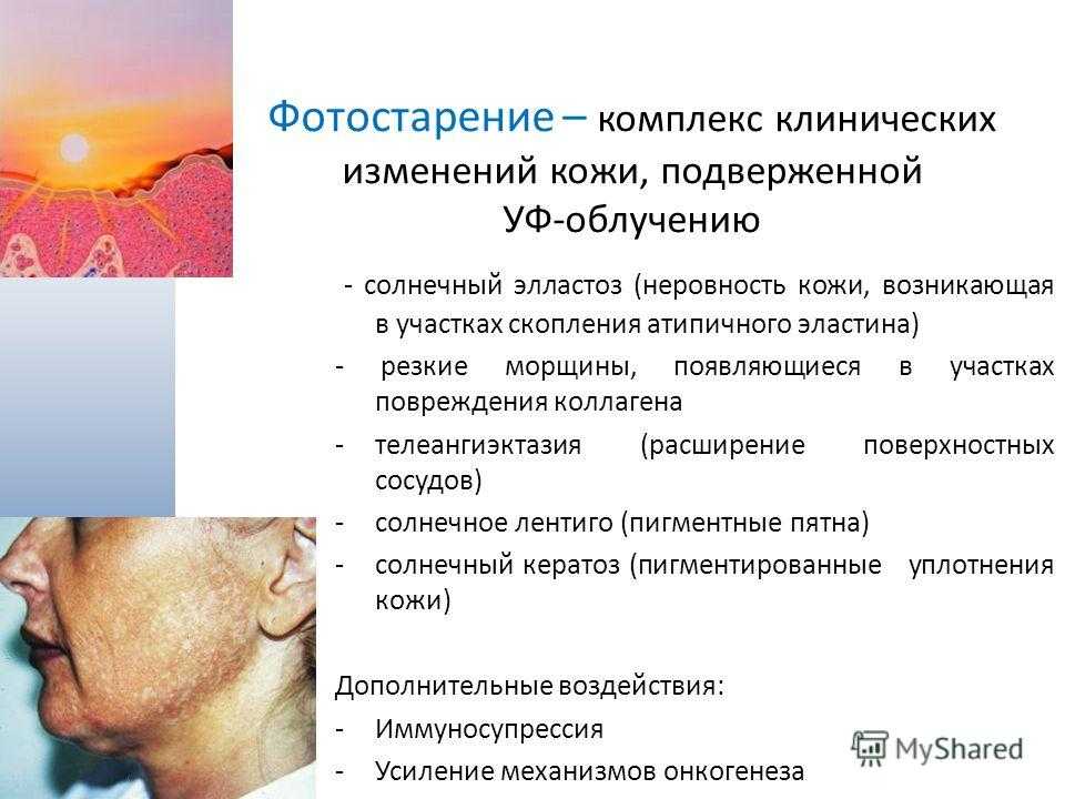 Что такое перспектива в фото и как её использовать